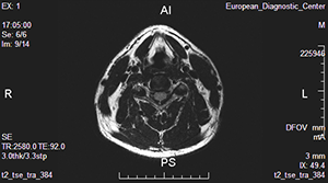 мрт шейного отдела 